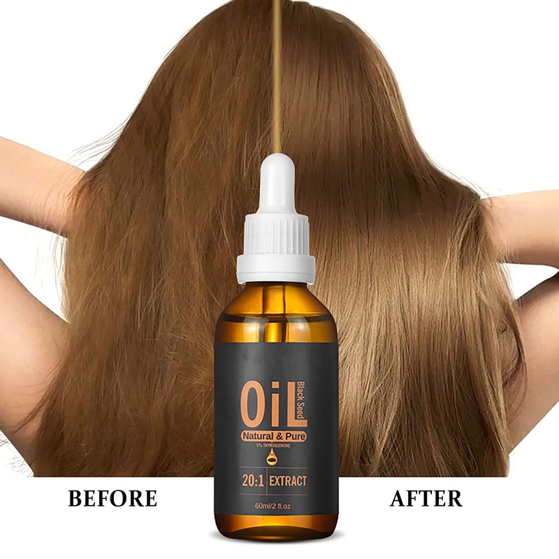 Black Seed Hair Oil-Cold-Pressed,2fl Oz Turkish Black Cumin Seed Oil