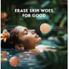 O Naturals Kojic Acid Soap, Turmeric & Orange + Exfoliating