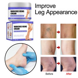 etitek Varicose Veins Cream for Legs，Leg Cream Soothing Joint Cream for Back Moisturizing Cream