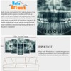 Modern 5 Panel Canvas Wall Art X-Ray Dental Tooth Oral