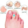 Mcvcoyh Adjustable 2 Loops Toe Splint, Hammer Toe Straightener with