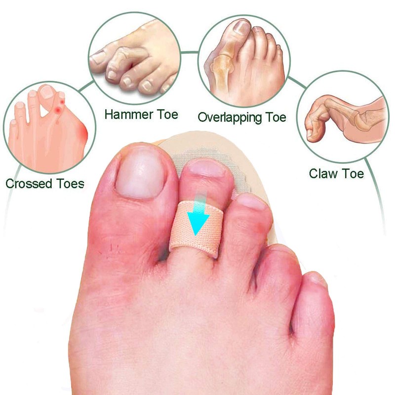 Mcvcoyh Adjustable 2 Loops Toe Splint, Hammer Toe Straightener with