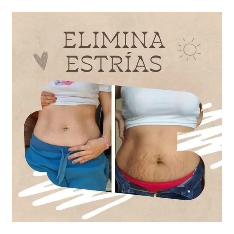 Farmasi Gel Paprika Chile Reduce Estrías Kit Piezas