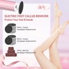 Electric Foot Callus Remover, 2-in-1 Foot & Nail Filer –