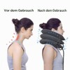 KARELLS Cervical Neck Traction Device, Neck Support, Neck Massager, Neck