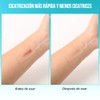 Hydrocolloid Roll, Para el Cuidado de Heridas, Hydrocolloid Bandages Roll,