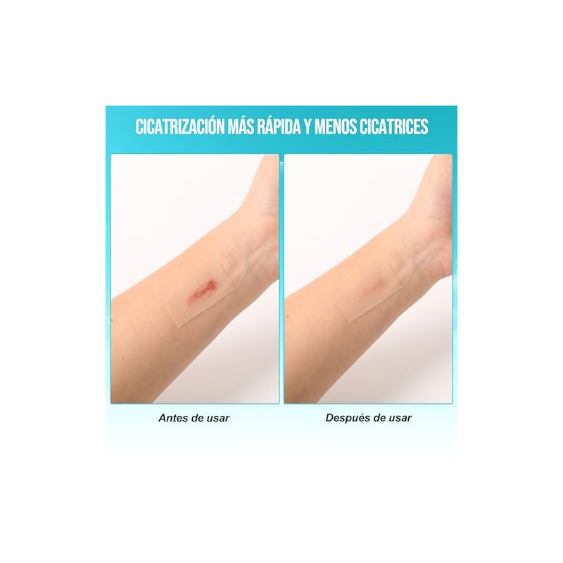 Hydrocolloid Roll, Para el Cuidado de Heridas, Hydrocolloid Bandages Roll,