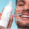 Etat Pur Espuma Limpiadora Limpia Y Suaviza, 150ml