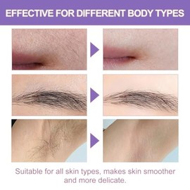 30ml Glow Hair Removal Oi,Cyperus Rotundus Skin Serum,Cold Pressed Pure Oil for Skin Hair Removal&Reduction,Inhibits Hair Growth,Relieves Post-Shave Discomfort,Mild Non-Irritating Portable&Easy to Use