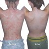 Salcura, Bioskin Zeoderm Skin Repair Moisturiser Twin Pack, Including Natural