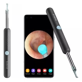 Bebird Limpiador De Oidos Otoscopio Endoscopio Inalámbrico