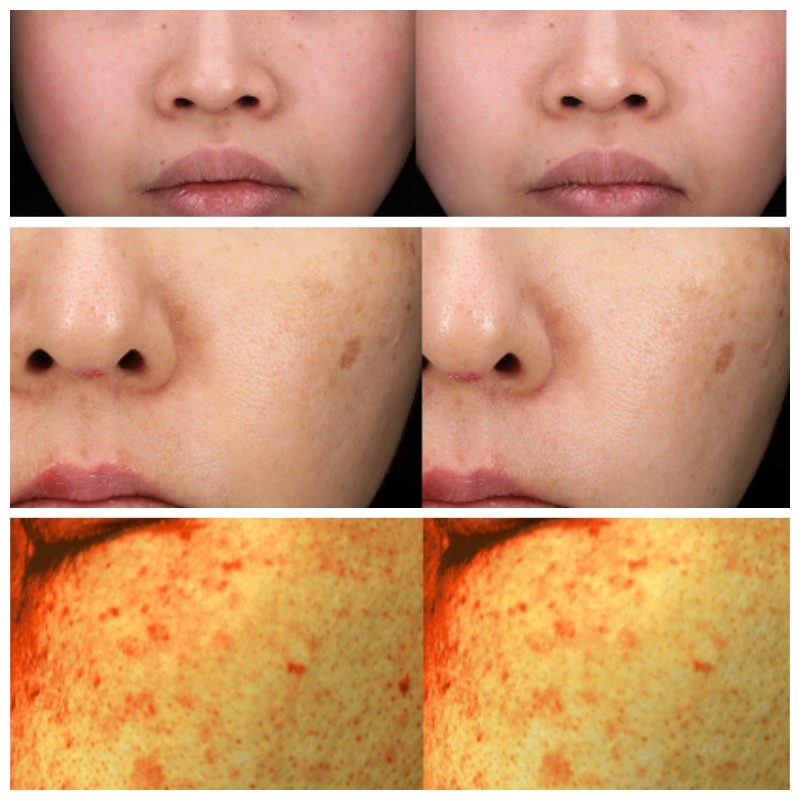 MILLIMILLI Medi Ampoule 15ml [Vita/Cica/Colla], Type:Colla-Glowing