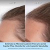 Destined For Density MegaStrength Plus Caffeine Plus Biotin Peptide Density Serum by Briogeo for Unisex - 1.5 oz Serum