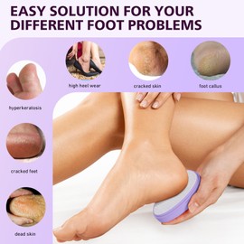 Baluca BALUCA Glass Foot File Callus Remover for Feet - Nano Glass Foot Scraper Scrubber Dead Skin Removal for Cracked Heels,Professional Pedicure Tool for Home, Salon, and Travel (Purple)