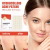 Parche Hidrocoloide Espinillas Imperfecciones F808
