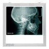 Med&Led Negatoscopio Dental Led 30x30 Lateral De Craneo, Panoramica