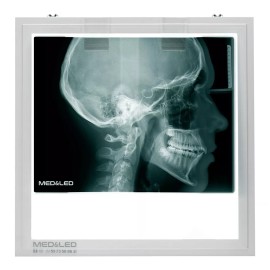Med&Led Negatoscopio Dental Led 30x30 Lateral De Craneo, Panoramica