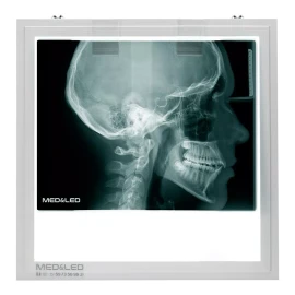 Med&Led Negatoscopio Dental Led 30x30 Lateral De Craneo, Panoramica