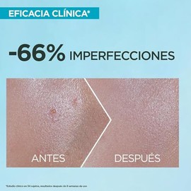 Garnier Super UV Protector Solar Facial Fluido Anti Imperfecciones con Acido Salicilico, Textura Invisible y Ligera, 40ml