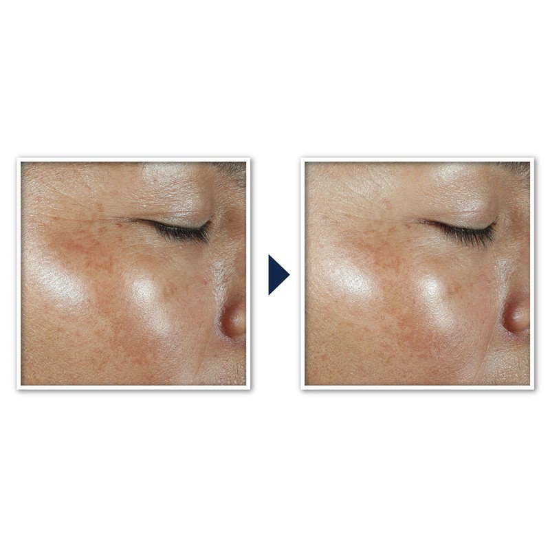 RoC Multi Correxion Revive + Glow Moisturiser SPF 30 |