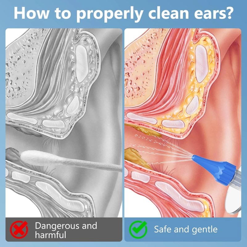 VITCOCO 1920P HD Ear Camera – USB Rechargeable Wax Removal