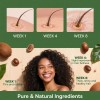 Aceite Para El Crecimiento Del Cabello Minnah Rosemary Fenog