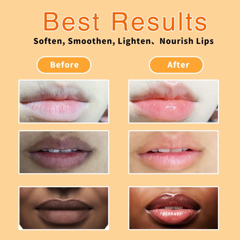 Turmeric Lip Balm for Smokers With Root Oil - Brightening