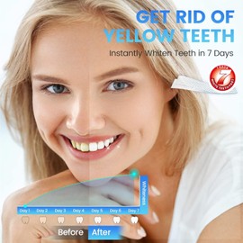 Teeth Whitening Kit, Teeth Whitening Strips, Tooth White Strips Pack for 14 Treatments, Safe On Enamel, Easy to Use Home Tooth Whitening kit, Advanced 5D Technology Teeth Whitening Kit
