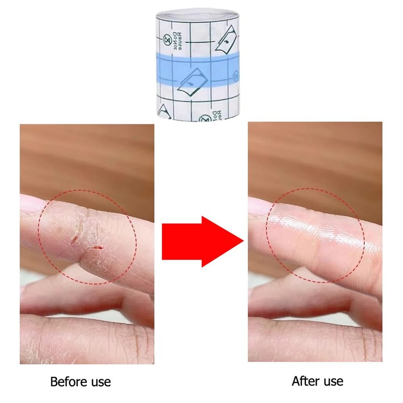 DeaHea Finger Tape Cracked Hands Patches Fingertip Bandages Knuckle Bandages