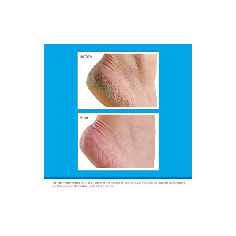 O’Keeffe’s® Healthy Feet Jar 91g 6 Pack