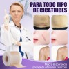 Parche De Cicatriz Silicona, Para Cesáreas,quemadura 1pcs