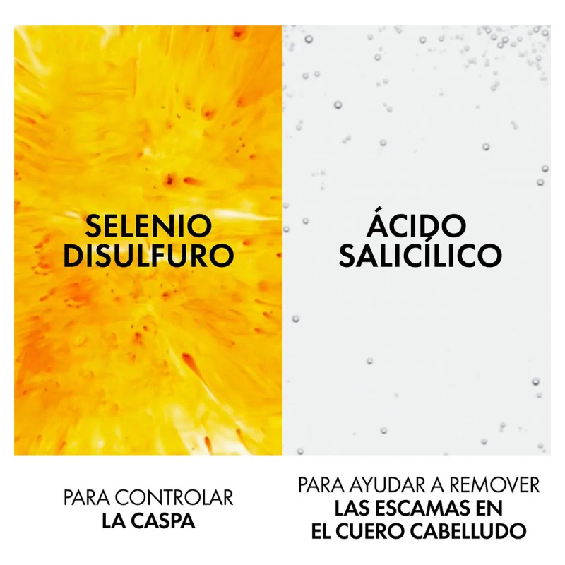 Vichy Dercos Shampoo Dermatolgico Anticaspa para Cabello Normal a Seco