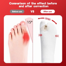 Wandefu Bunion corrector that can be worn with shoes everyday，toe separators for both men and women，fix the big toe brace of bunion hammer，Corrector and socks 2in1 (Black L 1 pc)
