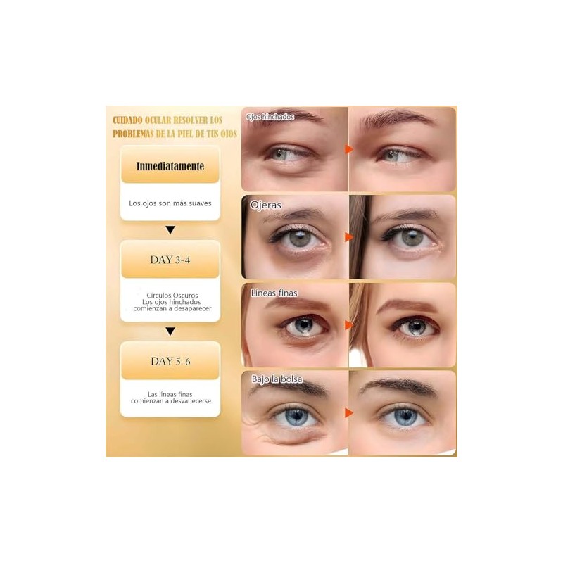 reductor de Bolsas y Ojeras