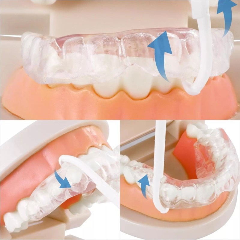 150 Dental Floss Picks for Braces & Retainers Orthodontic Cleaning