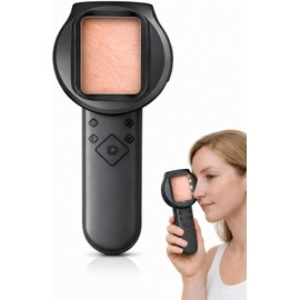 Digital Dermascope for Skin, Up to 500X Viewing, 2.8” IPS Screen, 2MP Camera, Manual Focus & 15 LED Lights, Pocket Camera for Skin & Scalp Observation