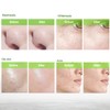 Blueskin Blackhead Remover Mask for Face: Black Peel Off Face
