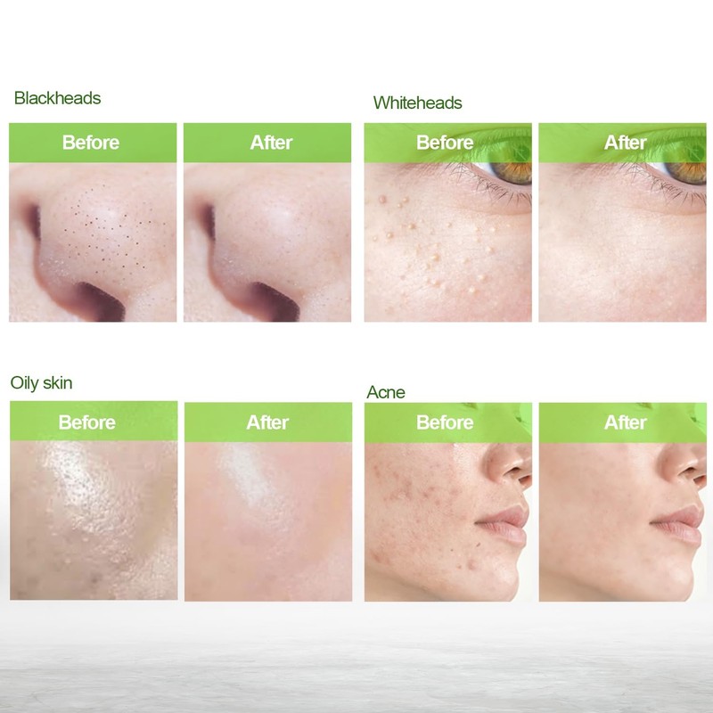 Blueskin Blackhead Remover Mask for Face: Black Peel Off Face