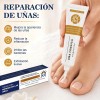 Crema Para El Cuidado De Las Uñas,pomada Reparadora De Uñas