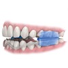 DenTek Comfort-Fit Dental Mouth Guards to Help Prevent Night Time