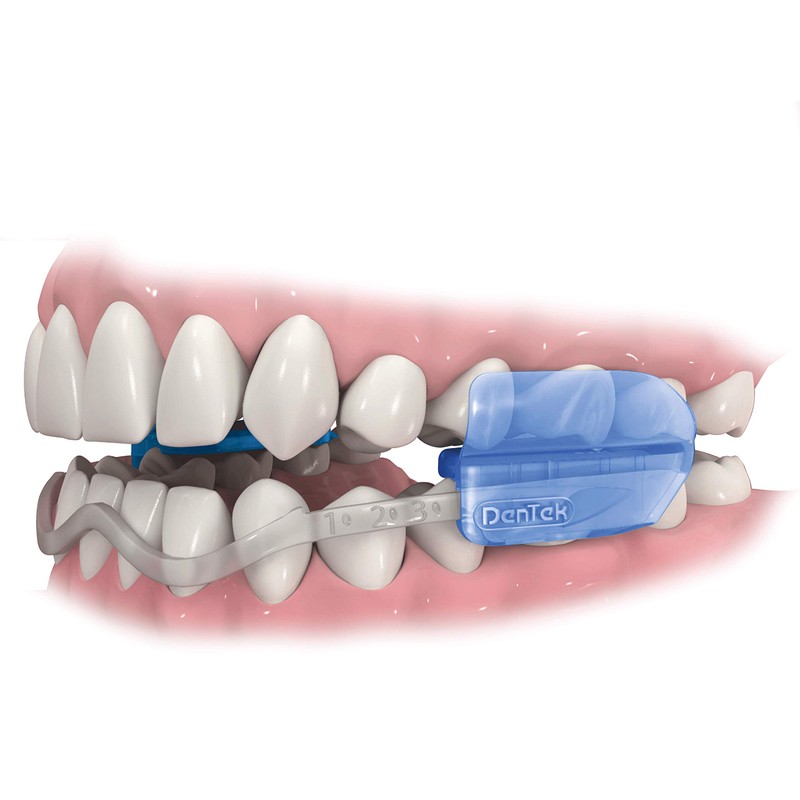 DenTek Comfort-Fit Dental Mouth Guards to Help Prevent Night Time
