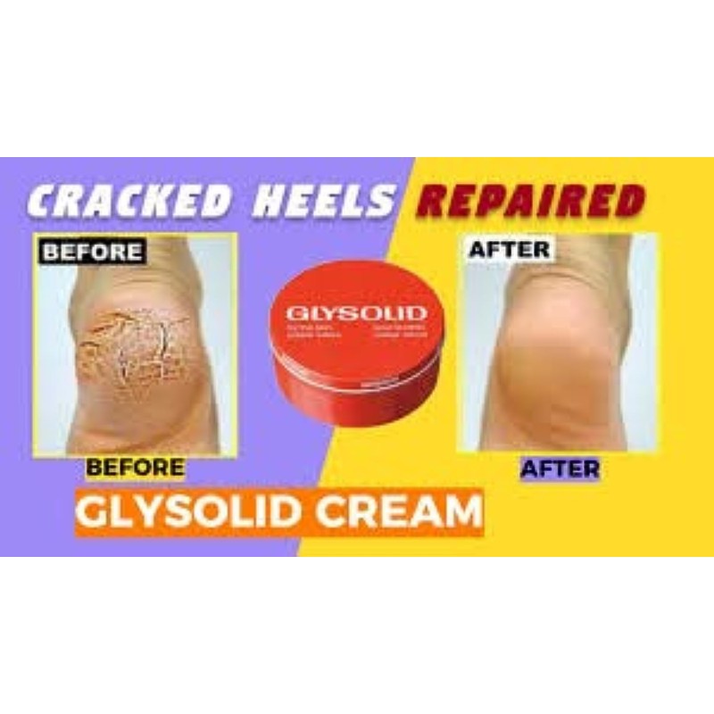 Glysolid Glycerin Cream - 125 Ml