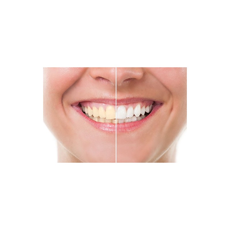 Blanqueador Dental Carbón Activado - 100% NATURAL - No OGM,