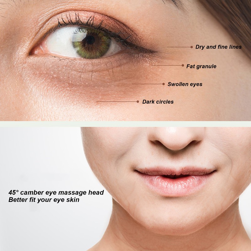 Eye Massage Cream Remove Dark Circles High Frequency Vibration Electric