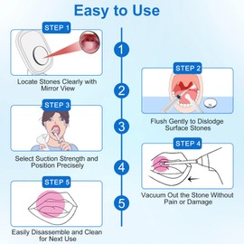 Tonsil Stone Remover Tool, Upgraded Electric Tonsil Stone Removal Kit - with Built-in LED Light & 6-Level Suction for Bad Breath Prevention, Oral Suction Device for Stone Removal