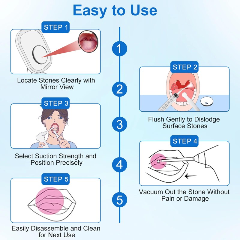 Tonsil Stone Remover Tool, Upgraded Electric Tonsil Stone Removal Kit