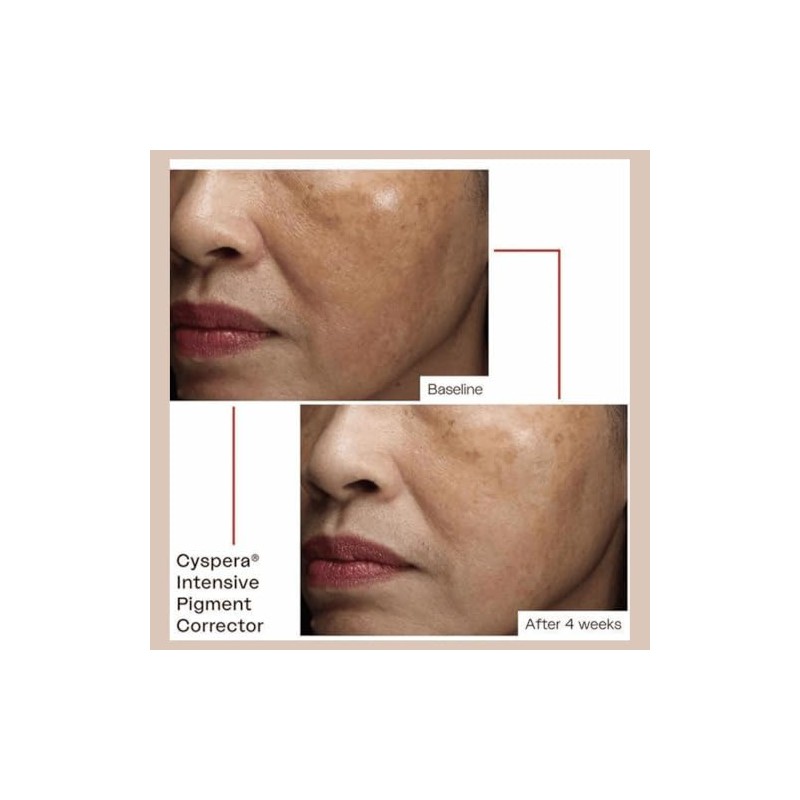 Scientist Cyspera - Despigmentante intensivo de nueva generacin para rostro,