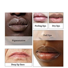 N.A.S.E 2PCS Lips Pink Fresh Lightening Bleaching Cream Treatment Remove Dark Smoke Lips Lips Bleaching whitening Essence Lip Balm (pink), 2 Count (Pack of 1)