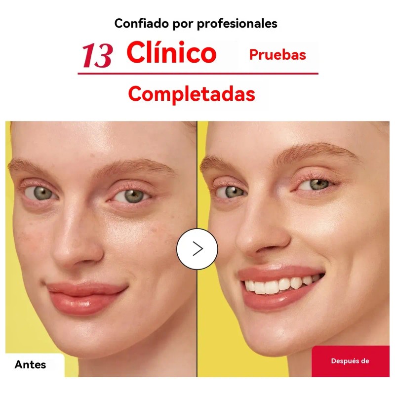 Suero Iluminador Con Vitamina C,serum Facial Hidratante