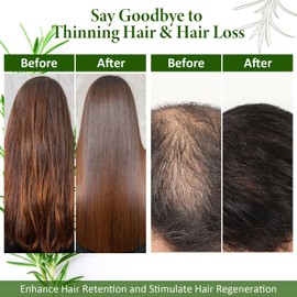 BoloShine Rosemary Oil for Hair Growth with Brush Scalp Massage Brush, Rosemary Oil Hair Eyebrow Eyelash Growth, Natural Rosemary Oil Hair Products for Women Men (30 ml)